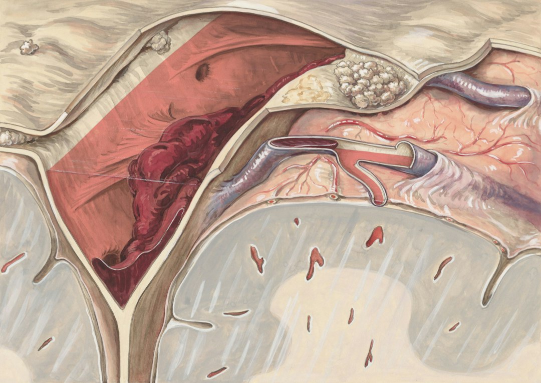 peripheral vascular intervention